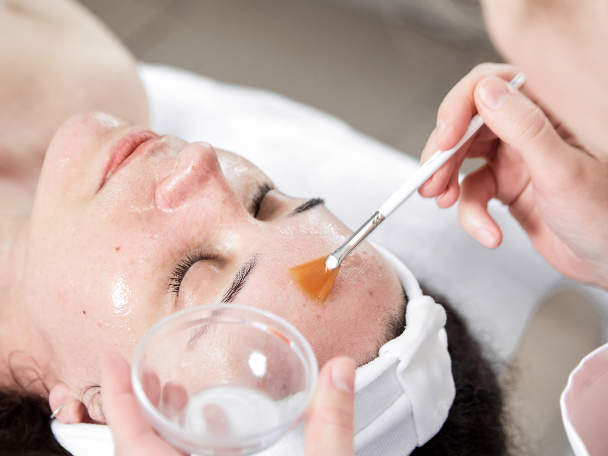 Medical Chemical Peels | Ultimate Aesthetics